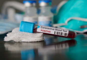 koronavirus covid19